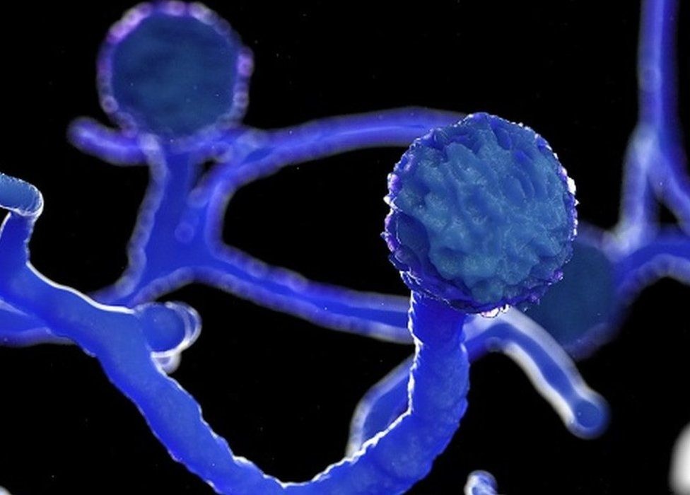 ಬ್ಲ್ಯಾಕ್ ಫಂಗಸ್ ನಿರ್ಲಕ್ಷ್ಡಿಸಬೇಡಿ    ಏಮ್ಸ್ ಮಾರ್ಗಸೂಚಿ ಸಲಹೆ, ಪತ್ತೆ ಕ್ರಮ ಮತ್ತು ಆರೈಕೆ ಸಲಹೆಗಳು ಇಲ್ಲಿವೆ