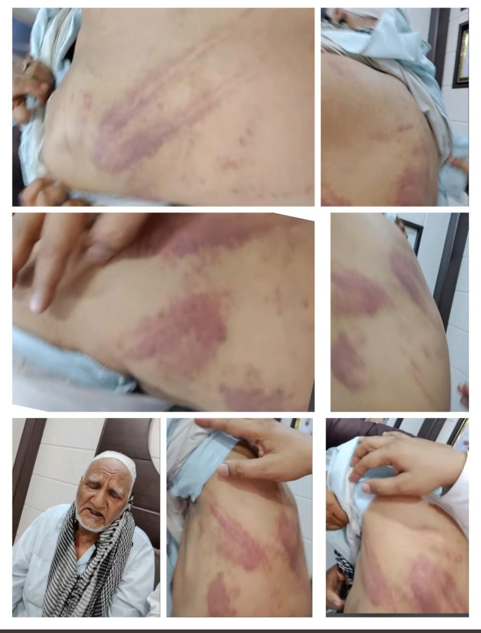 ಜೈಶ್ರೀರಾಮ್ ಕೂಗಲು ಹೇಳಿ ಅಜ್ಜನ ಗಡ್ಡ ಬೋಳಿಸಿದ ಪ್ರಕರಣ | ತಂದೆ ತಾಯ್ತ ಮಾರಾಟ ಮಾಡುತ್ತಿರಲಿಲ್ಲ ಎಂದ ಮಗ