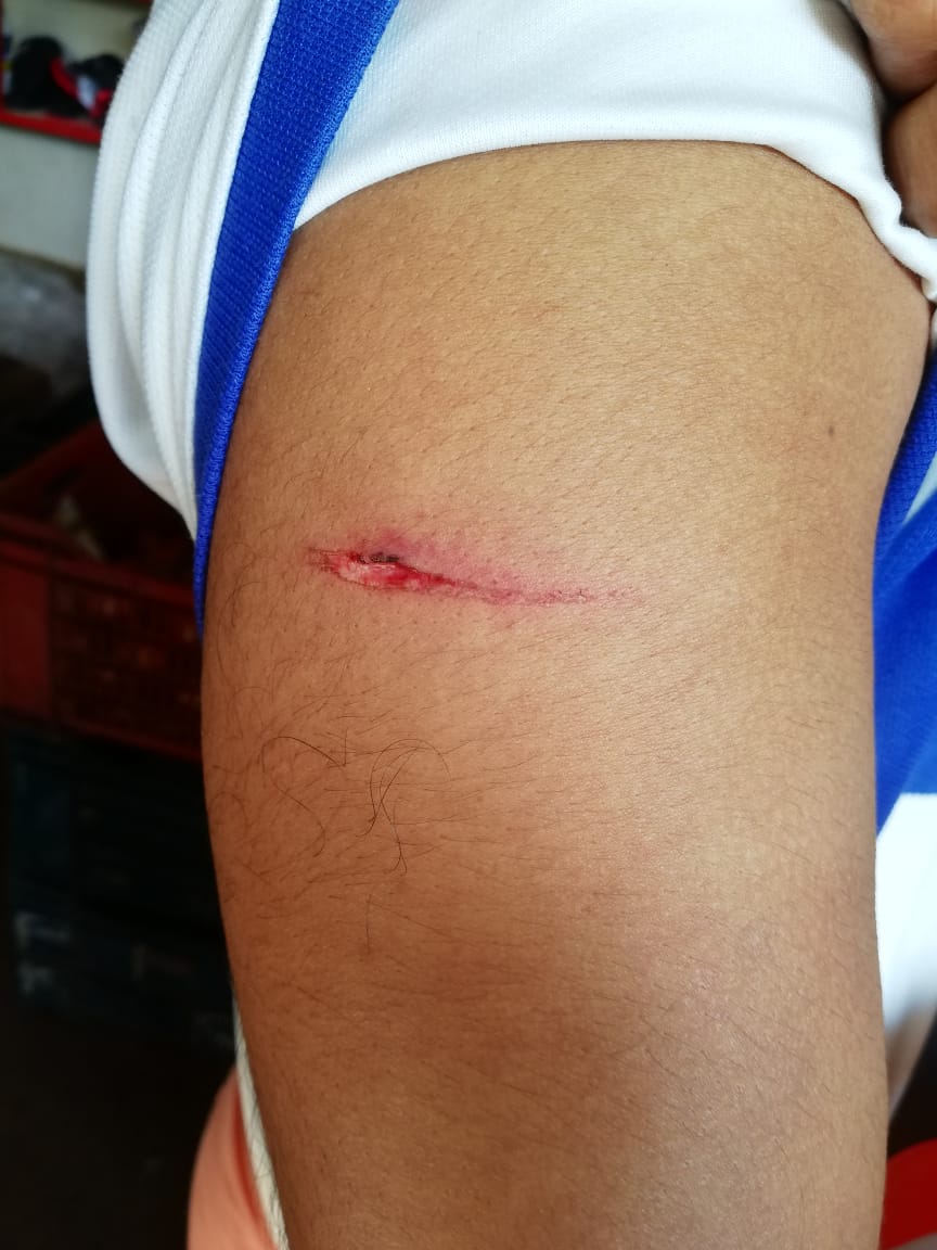 ತಡರಾತ್ರಿ ಮಂಗಳೂರಿನಲ್ಲಿ ಝಳಪಿಸಿದ ತಲ್ವಾರ್| ಹಿಂದೂ ಕಾರ್ಯಕರ್ತನ ಹತ್ಯೆಗೆ ವಿಫಲ ಯತ್ನ|