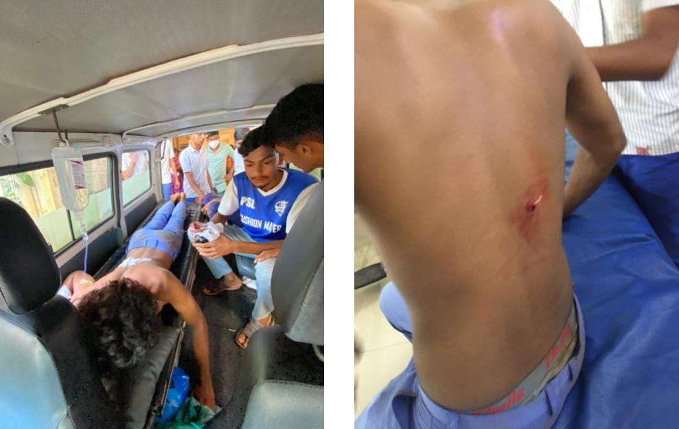 ಪುತ್ತೂರು: ಕೊಂಬೆಟ್ಟು ಕಾಲೇಜಿನಲ್ಲಿ ಮತ್ತೆ ವಿದ್ಯಾರ್ಥಿಗಳಿಗೆ ಹಲ್ಲೆ| ಚಾಕು ಇರಿದು ಇಬ್ಬರು ಗಂಭೀರ