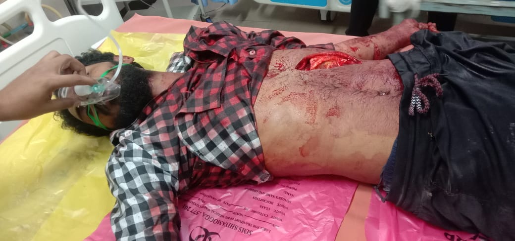 ಶಿವಮೊಗ್ಗದಲ್ಲಿ ಬಜರಂಗದಳ ಕಾರ್ಯಕರ್ತನ ಬರ್ಬರ ಹತ್ಯೆ