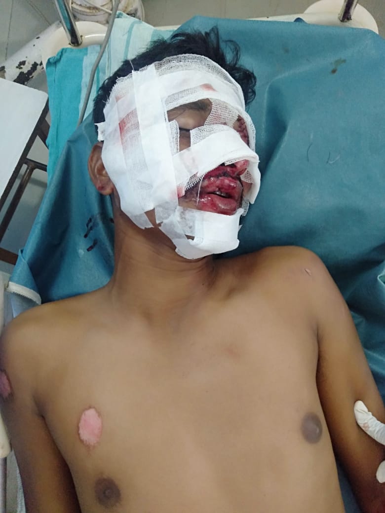 ಮಾಣಿ : ರಿಕ್ಷಾ ಪಲ್ಟಿಯಾಗಿ ಚಾಲಕ ಗಂಭೀರ| ಆಸ್ಪತ್ರೆಗೆ ಸಾಗಿಸಿದ ಯುವ ಕಾಂಗ್ರೆಸ್ ಕಾರ್ಯಕರ್ತರು