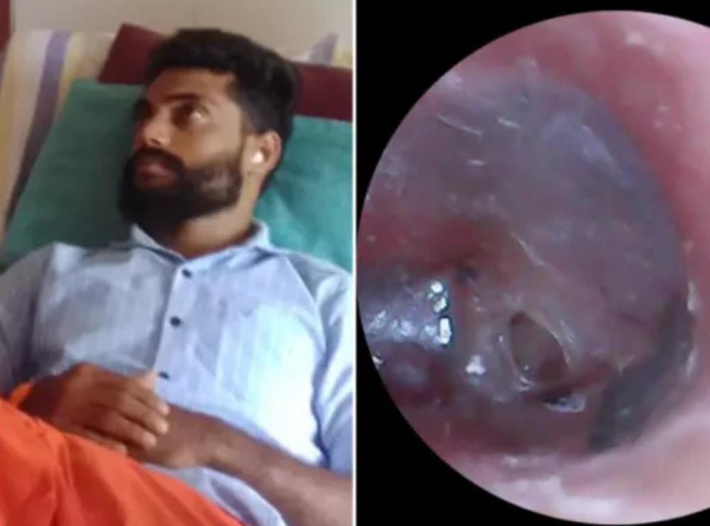ಪುತ್ತೂರು: ಪೊಲೀಸರಿಂದ ದೌರ್ಜನ್ಯಕ್ಕೊಳಗಾದ ಹಿಂದೂ ಕಾರ್ಯಕರ್ತನ ಕಿವಿ ತಮಟೆ ಡ್ಯಾಮೇಜ್| ಗಂಭೀರ ಸ್ವರೂಪ ಪಡೆದ ಪ್ರಕರಣ