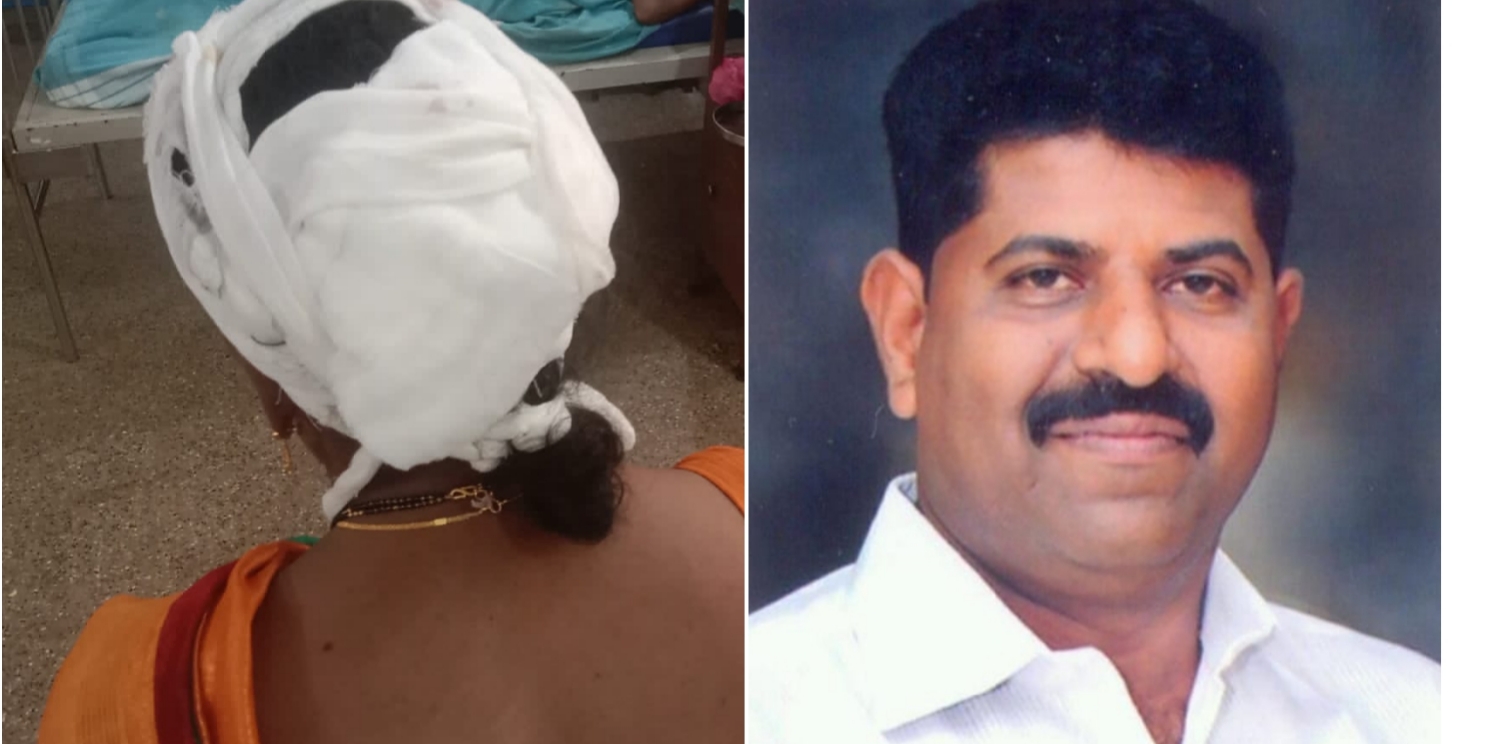 ಉಡುಪಿ : ಜಾಗದ ತಕರಾರಿಗೆ ಸಂಬಂಧಿಸಿ ದಂಪತಿ ಮೇಲೆ ಹಲ್ಲೆ ನಡೆಸಿದ ನಗರಸಭಾ ಸದಸ್ಯ