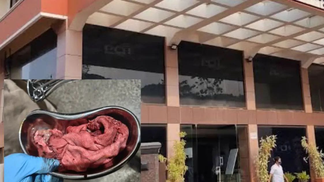 ಪುತ್ತೂರು: ಹೆರಿಗೆ ಶಸ್ತ್ರಚಿಕಿತ್ಸೆ ವೇಳೆ ಸರ್ಜಿಕಲ್ ಬಟ್ಟೆ ಹೊಟ್ಟೆಯೊಳಗಿಟ್ಟು‌ ಹೊಲಿಗೆ ಹಾಕಿದ ವೈದ್ಯ| ಖಾಸಗಿ ಆಸ್ಪತ್ರೆ ವಿರುದ್ದ ಕುಟುಂಬಸ್ಥರಿಂದ ದೂರು