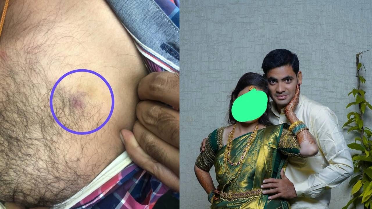 ಪತ್ನಿ ಮತ್ತು ಆಕೆಯ ಕುಟುಂಬಸ್ಥರಿಂದ ಮಾನಸಿಕವಾಗಿ ಹಲ್ಲೆ : ಪತಿಯಿಂದ ದೂರು